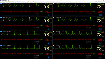 8床位多參數(shù)監(jiān)護畫面