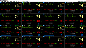 16床位多參數(shù)監(jiān)護畫面