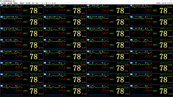 32床位多參數(shù)監(jiān)護畫面
