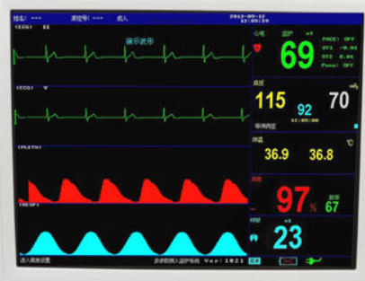 深入解析腦電圖：揭示大腦活動背后的電位信號之謎